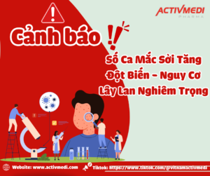 Cảnh báo bệnh sởi